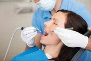 Composite Fillings 